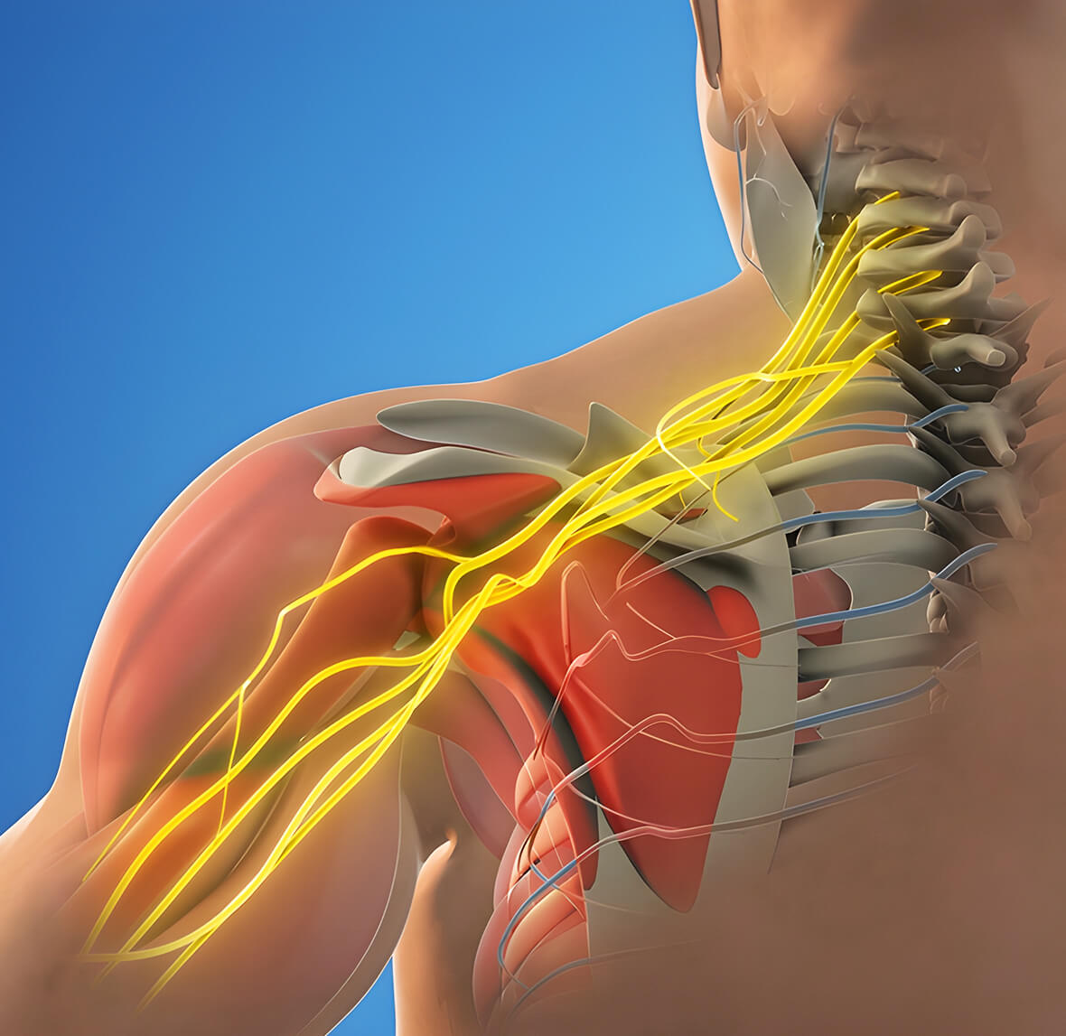 Brachial plexus treatment