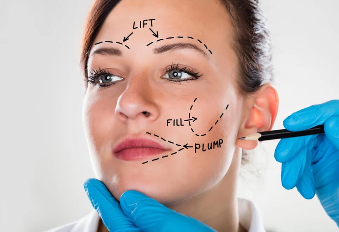 Best Face Lift Surgery in Delhi | Face Lifting Treatment