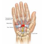 Carpal Tunnel Syndrome Surgery in Delhi: Cost, Procedure & Recovery