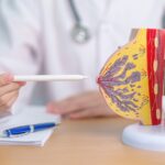 advanced breast surgery treatment in Delhi by Dr. Anubhav Gupta