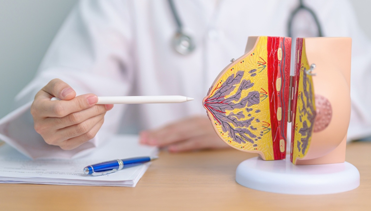 advanced breast surgery treatment in Delhi by Dr. Anubhav Gupta