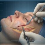 best face surgery treatment in delhi