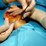 Best Hand Surgery Specialist for Hand and Wrist Treatment – Dr. Anubhav Gupta