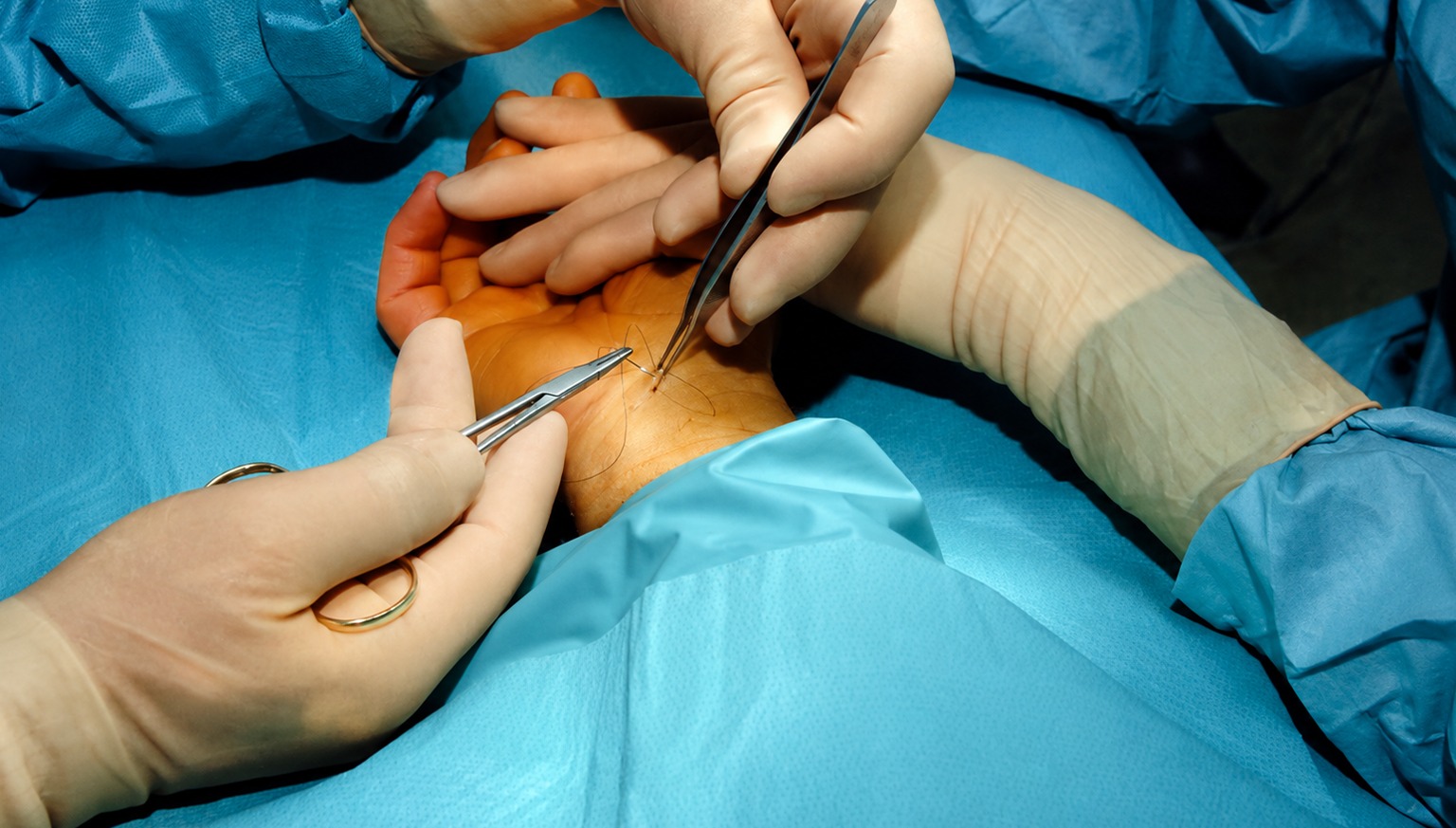 Best Hand Surgery Specialist for Hand and Wrist Treatment – Dr. Anubhav Gupta