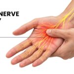 Hand Nerve Injury | Dr Anubhav Gupta
