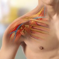 BRACHIAL-PLEXUS-TREATMENT