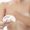Breast-Reconstruction