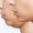 Cheek-&-Chin-Reshaping