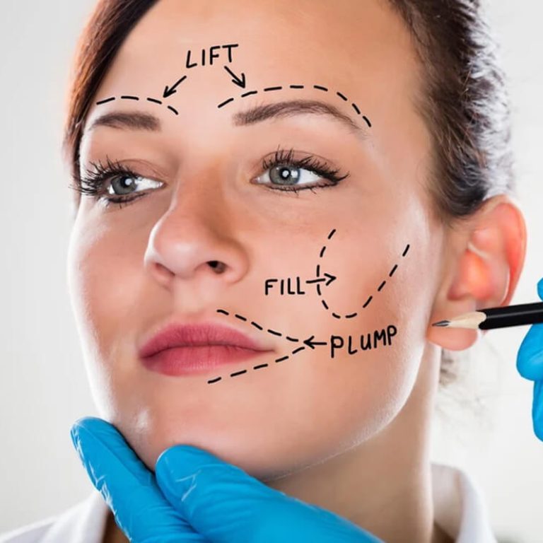 Best Face Lift Surgery in Delhi | Face Lifting Treatment by Dr. Anubhav Gupta