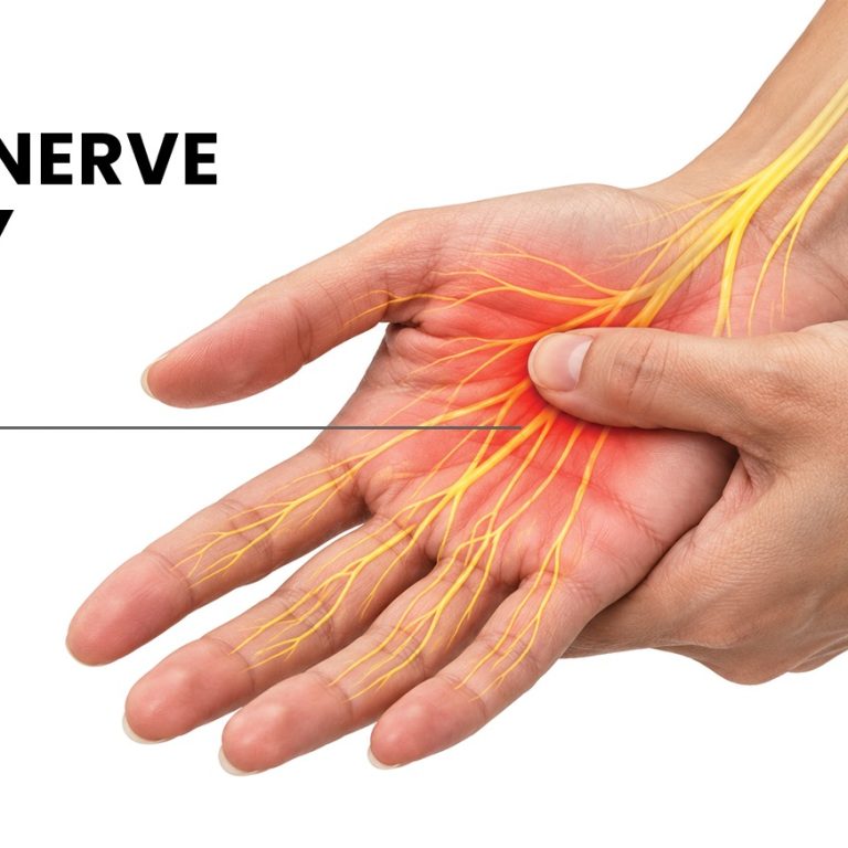 Hand Nerve Injury | Dr Anubhav Gupta