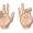Median Nerve Palsy Treatment in Delhi | Dr. Anubhav Gupta
