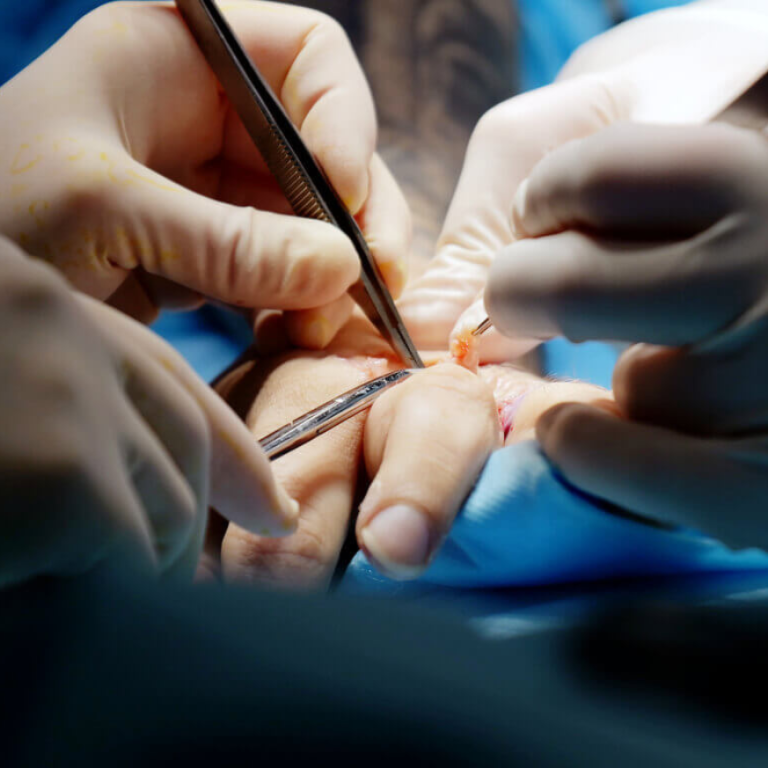 Best Hand Specialist in Delhi for Hand Injuries, Fractures and Nerve Problems