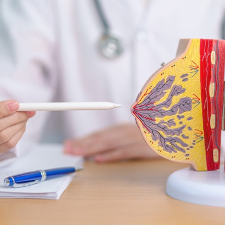 advanced breast surgery treatment in Delhi by Dr. Anubhav Gupta