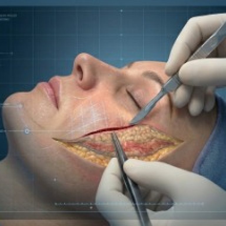 best face surgery treatment in delhi