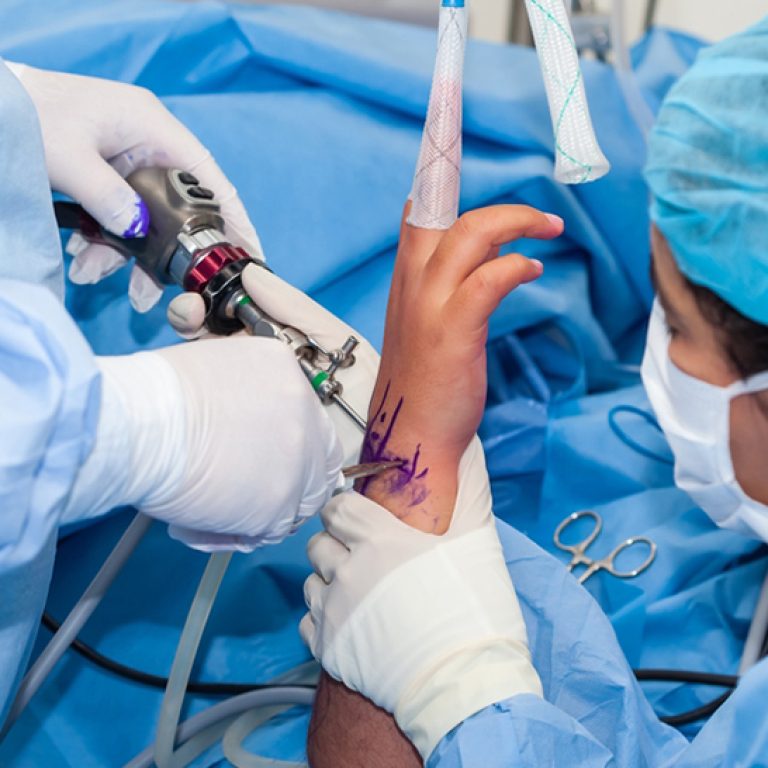 Top Hand Surgeon in Delhi | Trusted hand Doctor Anubhav Gupta